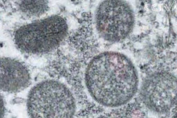 猴痘病毒已发生人际传播