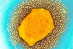 专家：猴痘病毒疑进化 更具传染性