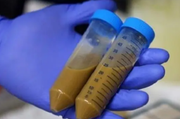 新加坡成立第一家粪便银行